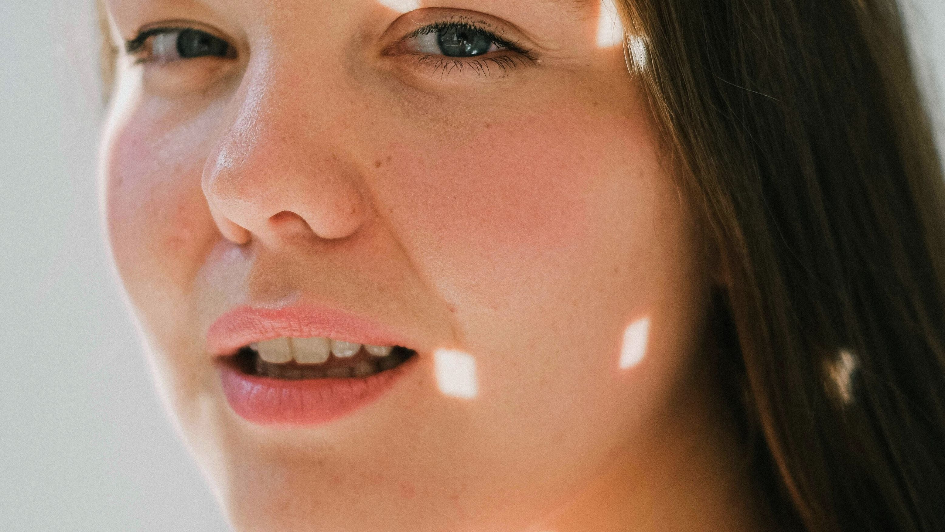 Rosacea kan ge rodnad, känslighet och olika typer av hudsymtom