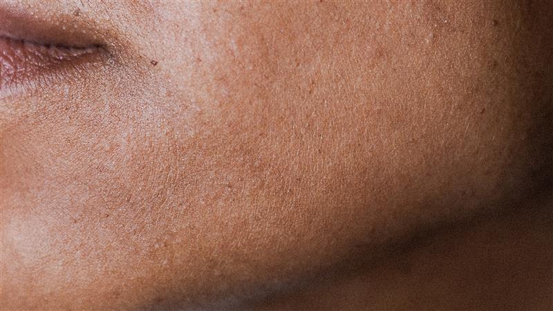 Hudvård på vintern – Expertens bästa hudvårdstips mot torr hud