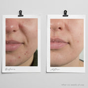 Breakout Control Trio