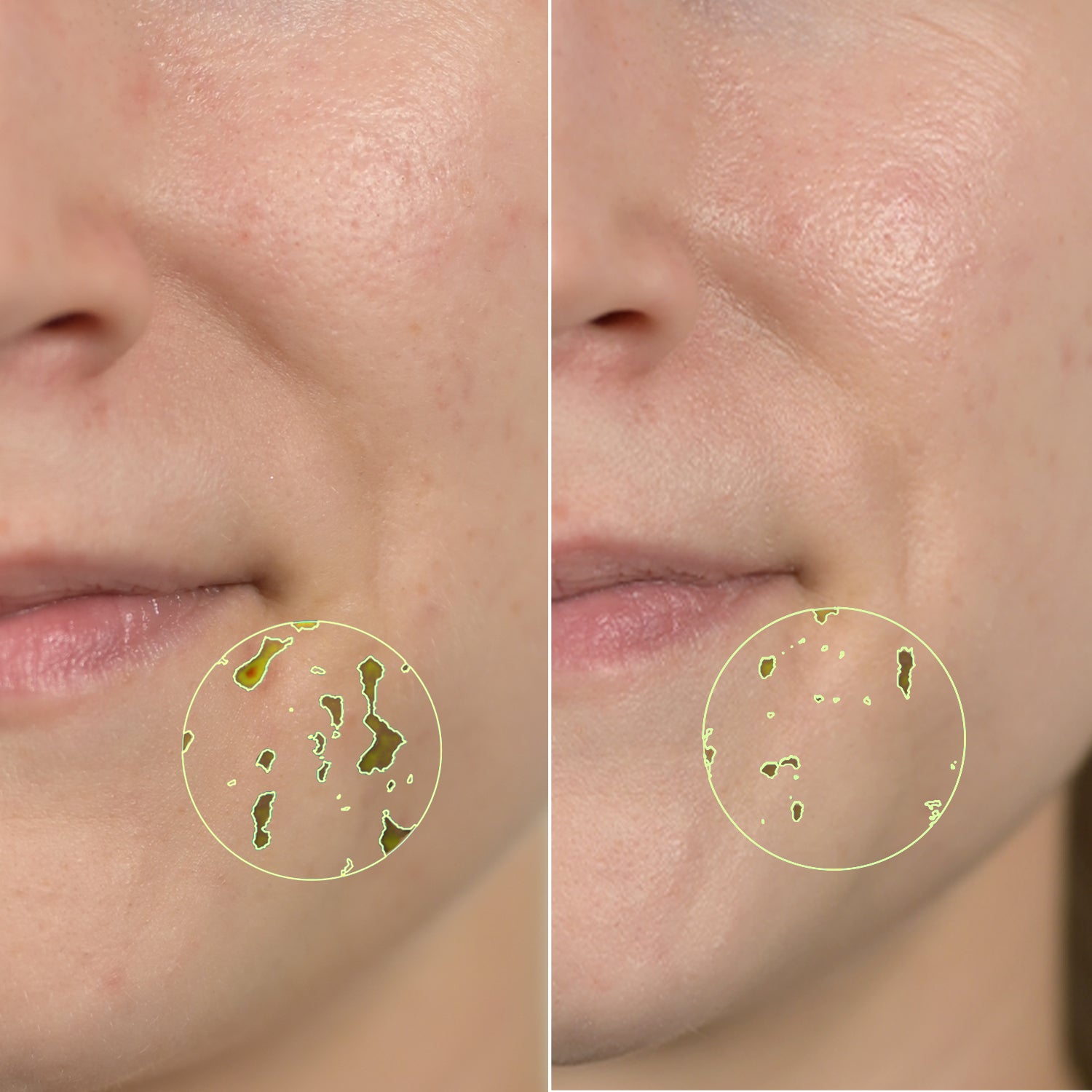 56% improved skin texture