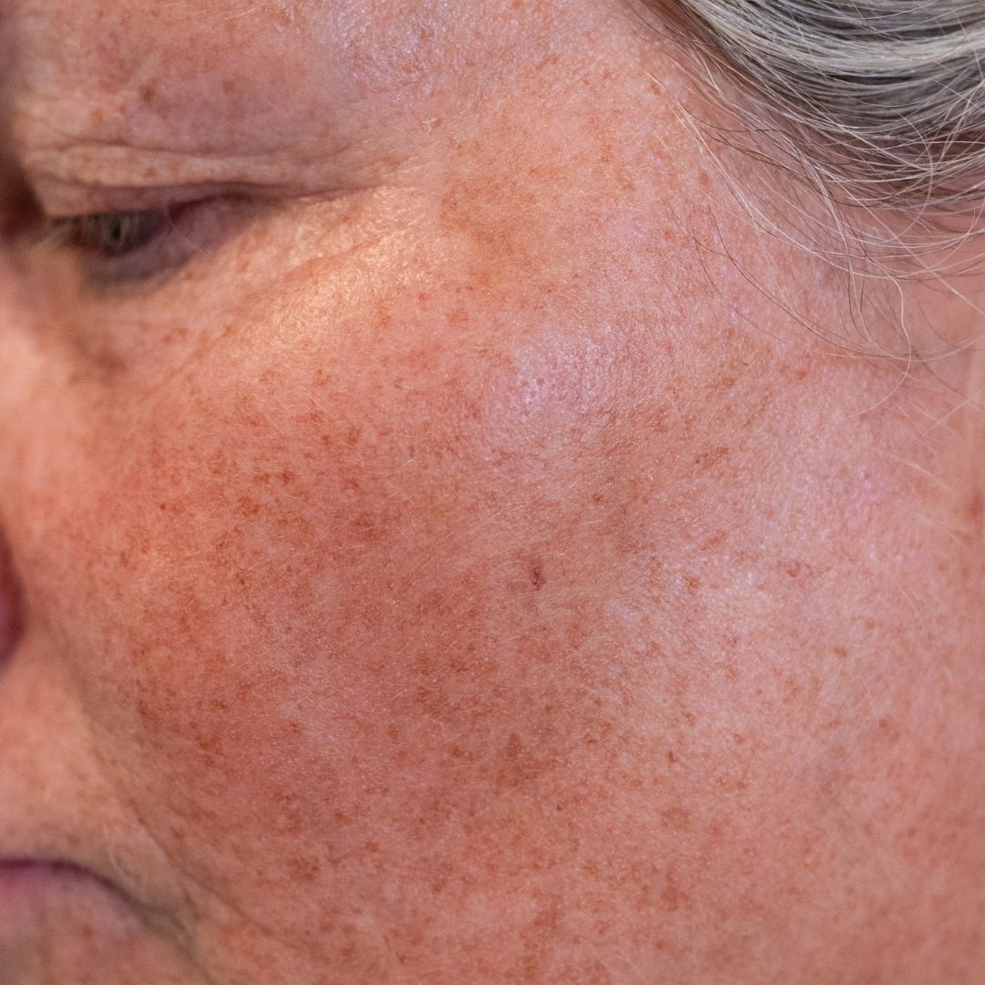Jessica, 56 år