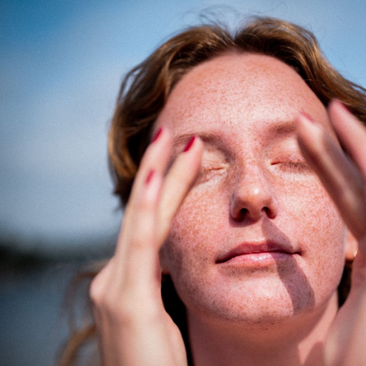 skinome_crm26_1x1_rosacea.jpg
