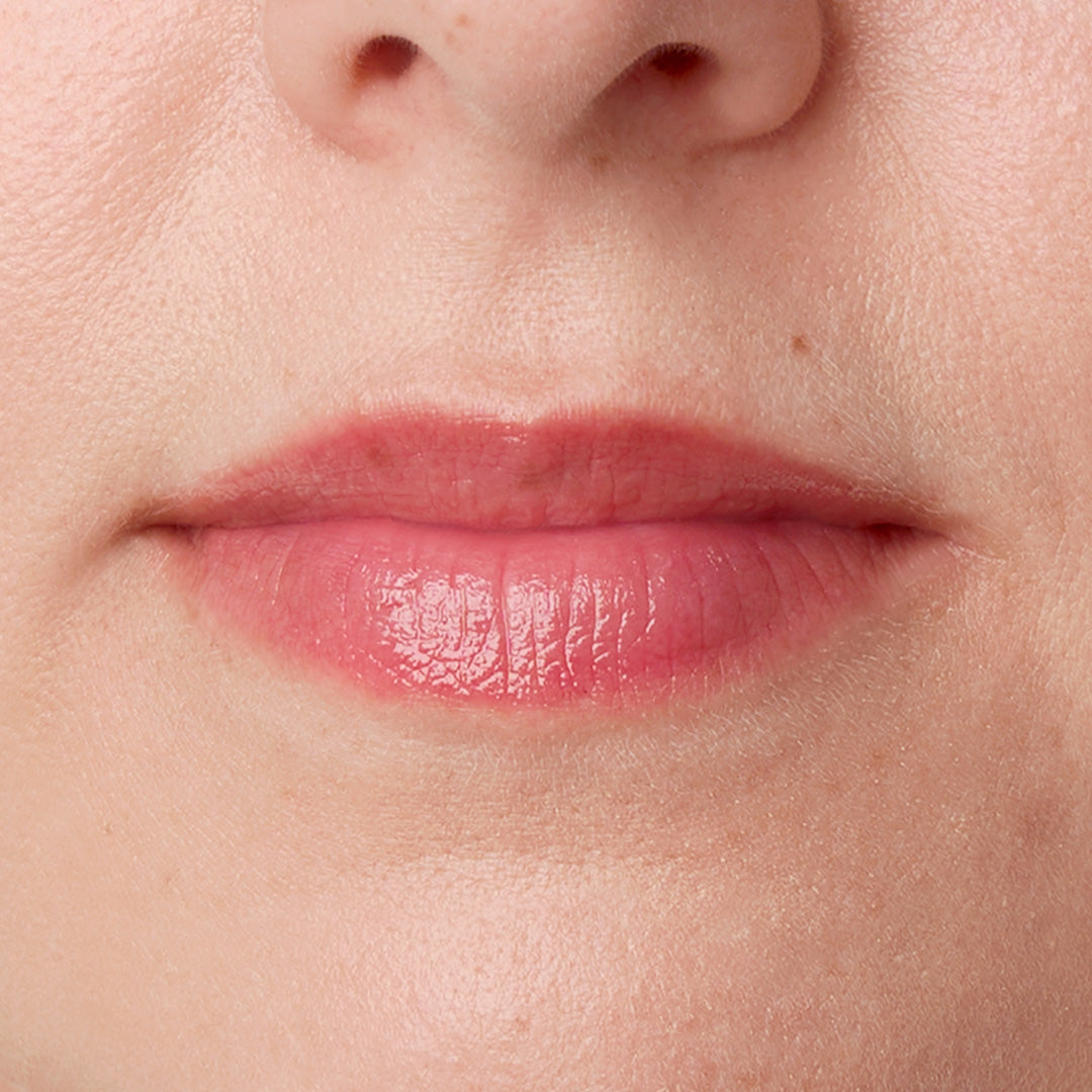 skinome_lip_repair_natural_pink_after_1x1_d9eb40e1-20f2-4ab8-9ee4-2ecbd31bd872.jpg