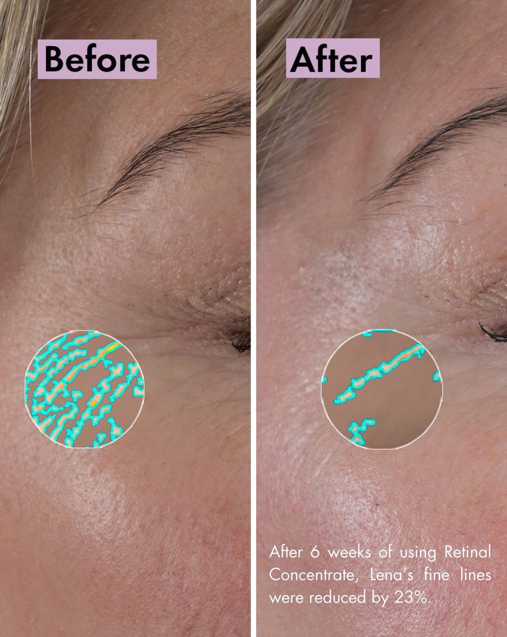 Retinal Concentrate | Nattkoncentrat med retinal för slätare hud | Skinome