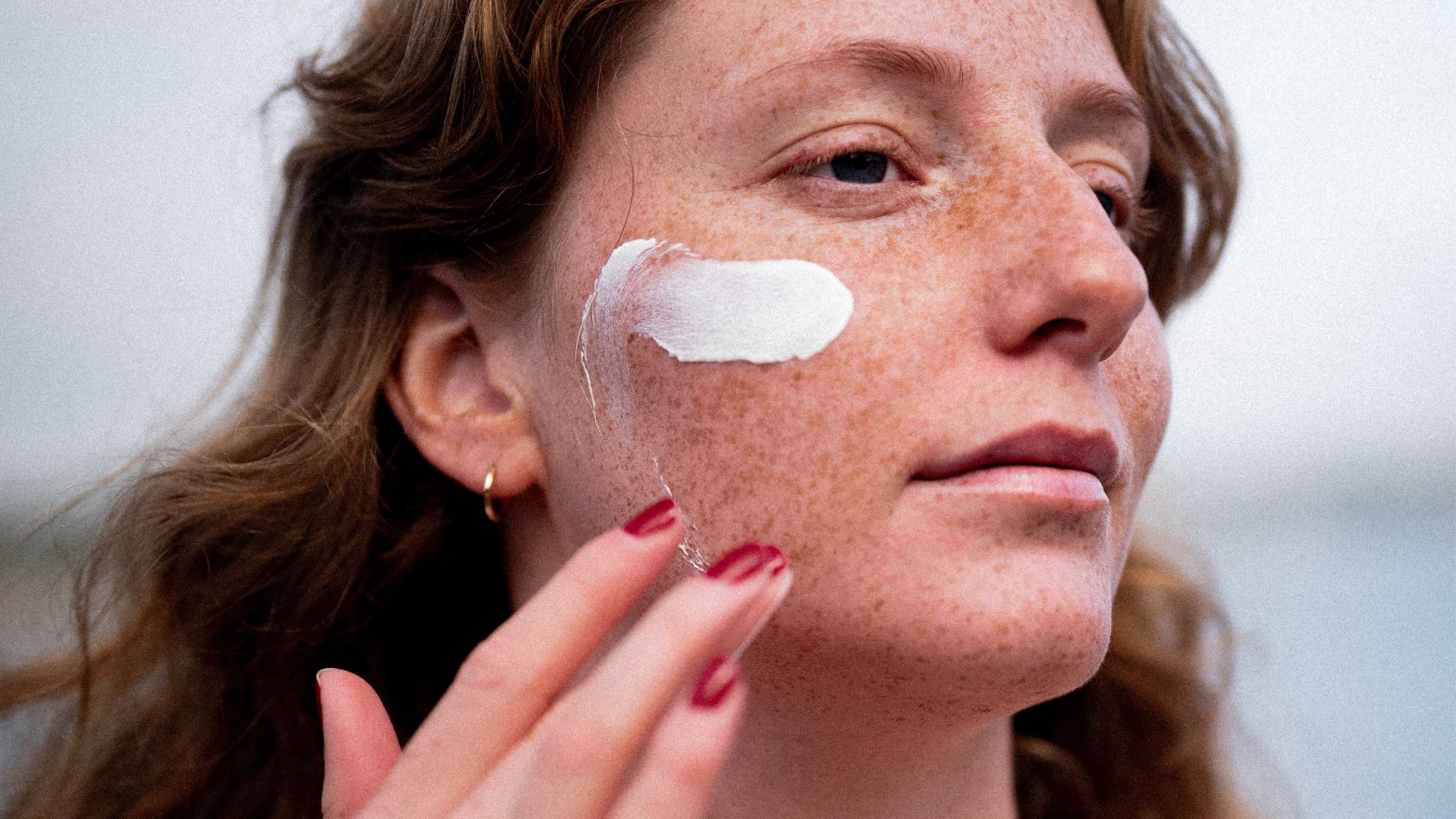 skinome_web26_16x9_rosacea_sol_4.jpg
