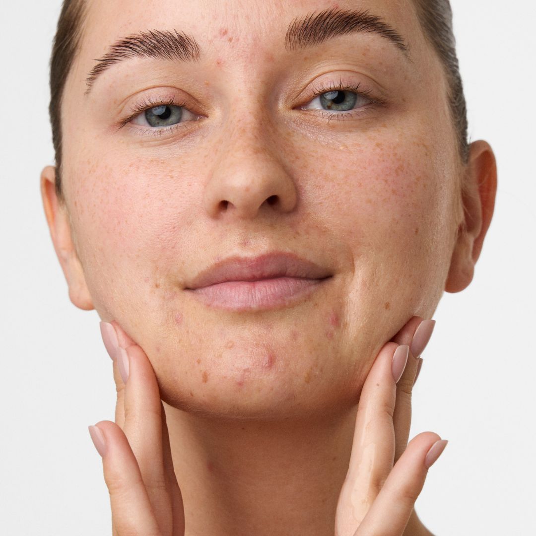 skinome_web26_1x1_ARC_model_22b.jpg