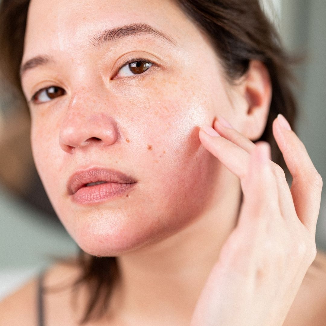skinome_web26_1x1_ekero_model_18_1.jpg