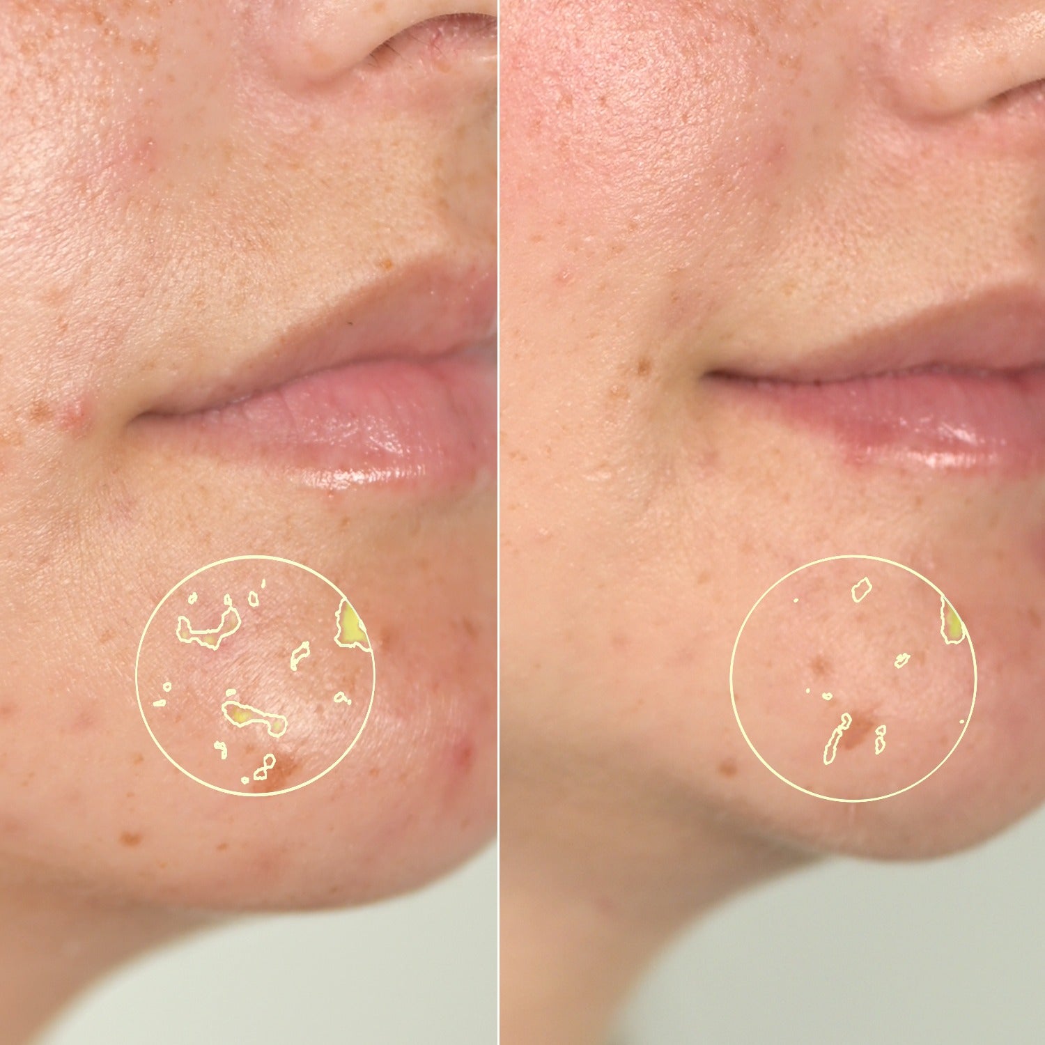 49 % forbedret hudtekstur