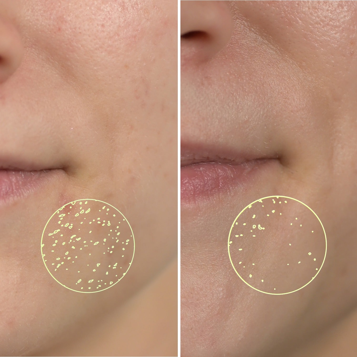 56 % forbedret hudtekstur