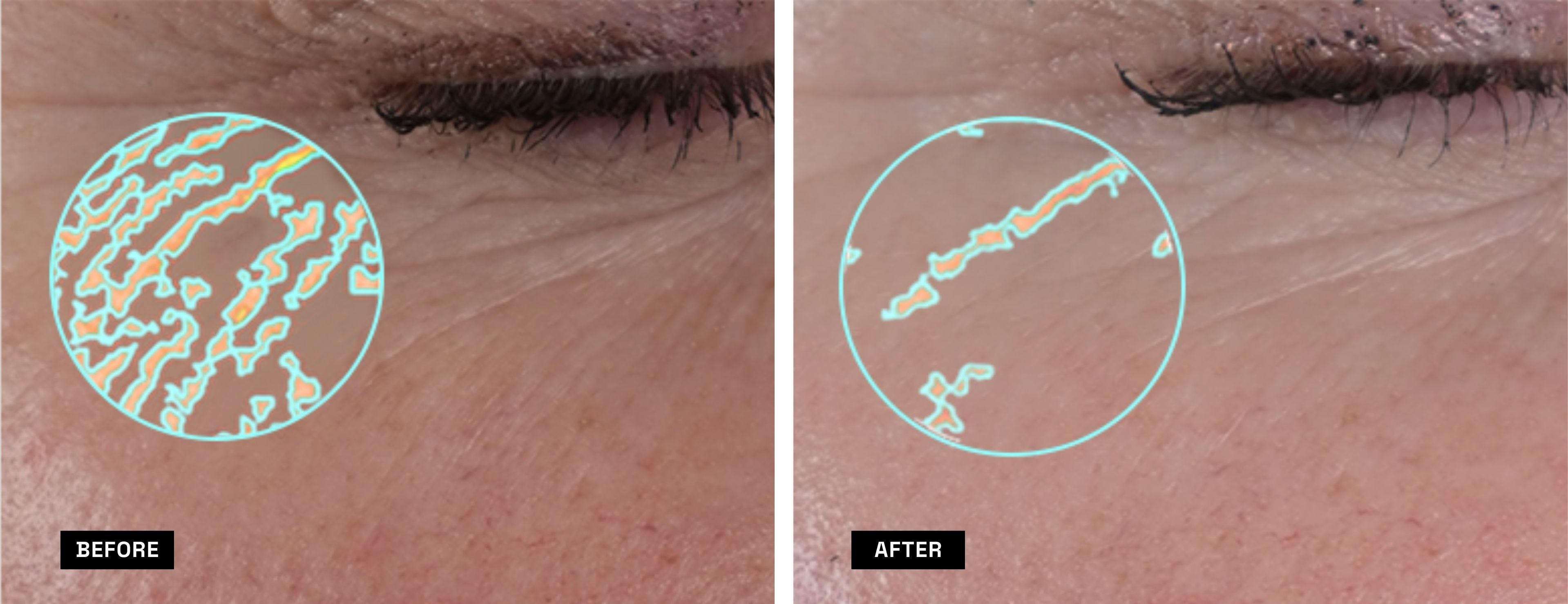 web26_32x9_beforeafter_rc_lena.jpg