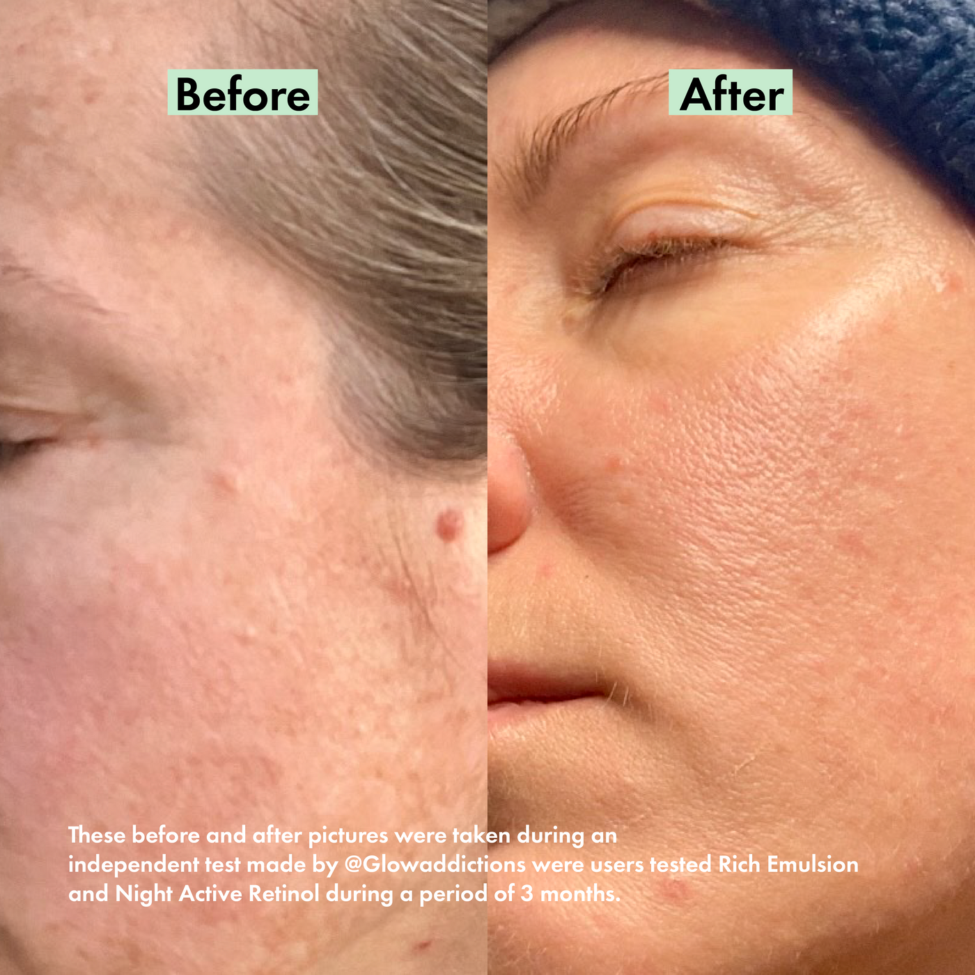 Night Active Retinol
